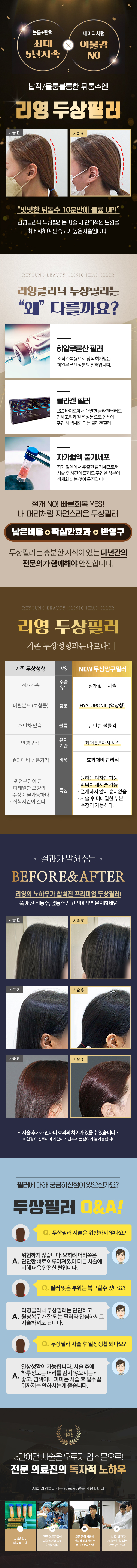 동안탄력의 비결! 내 피부 리쥬란으로 힐링해~