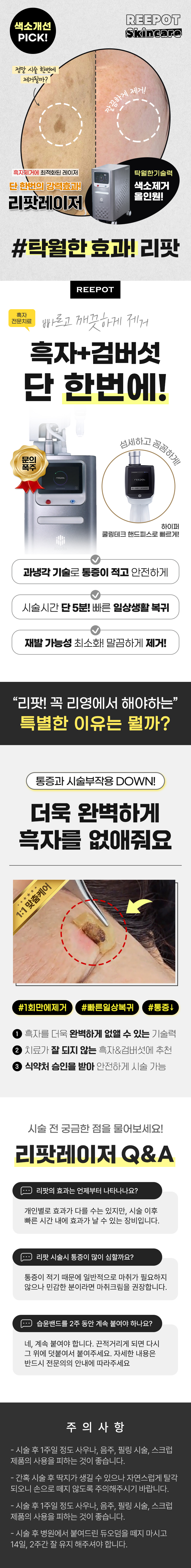 흑자제거에 최적화된 레이저. 단 한번의 강력효과! 리팟레이저
