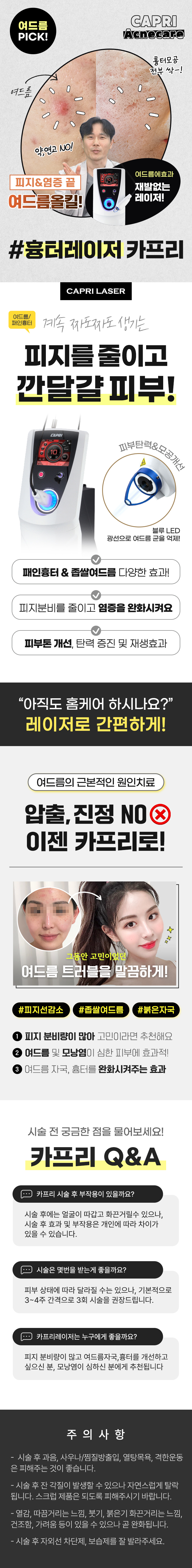 근본적인 여드름치료! 흉터+여드름 카프리 레이저!