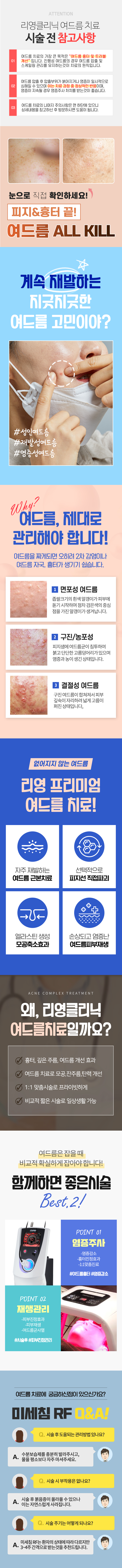 여드름치료+재발방지! 피지선 파괴! 리영 미세침 RF