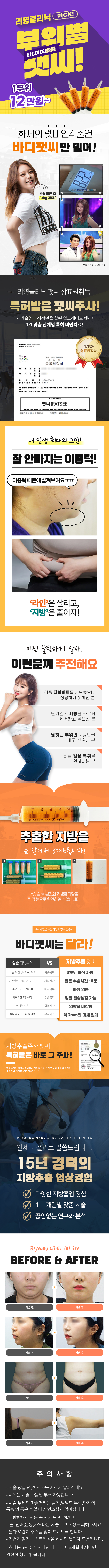 지방추출주사 팻씨 특허받은 바로 그 주사!  팻씨주사는 리영클리닉에서 자체적으로 오랜 연구와 경험을 통하여 개발하고 특허를 받은 시술입니다.