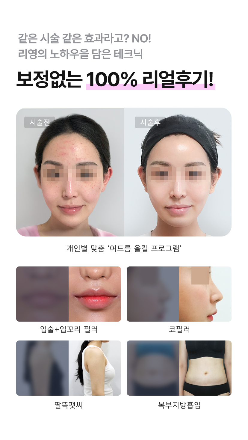 같은 시술 같은 효과라고 NO! 리영의 노하우를 담은 테크닉. 보정없는 100% 리얼후기!