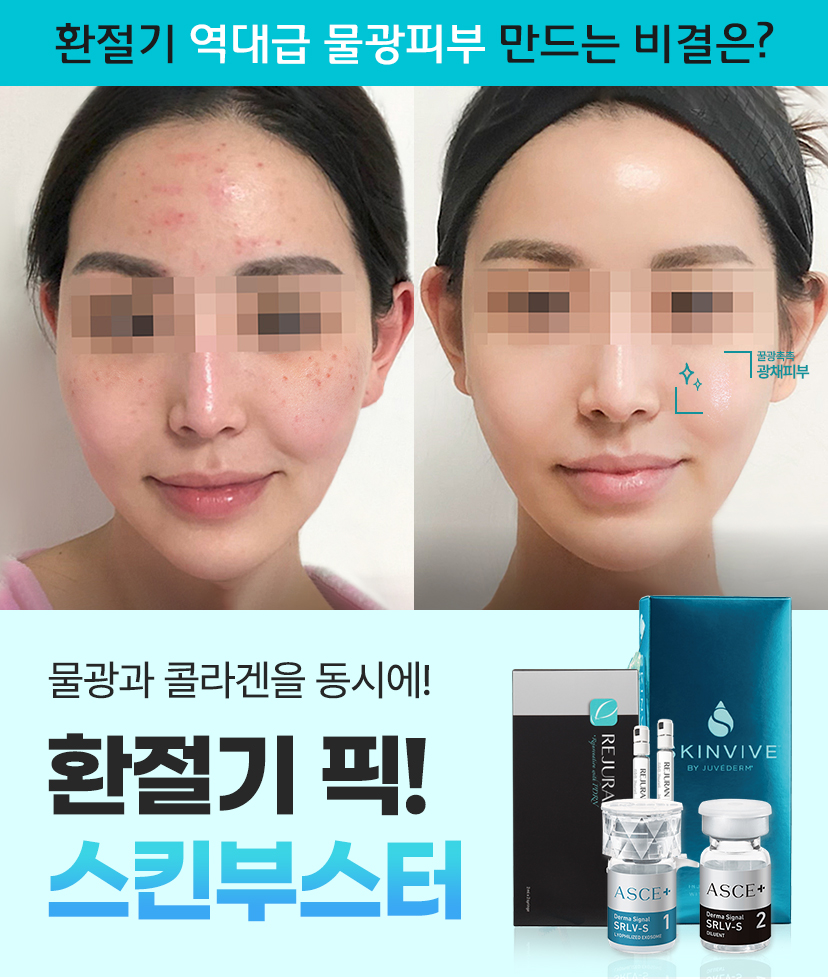 스킨부스터