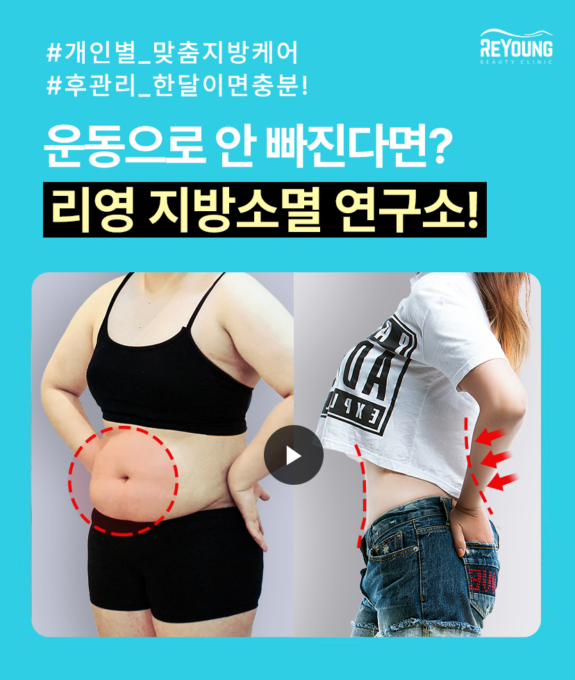 리영클리닉 개인별_맞춤지방케어, 후관리_한달이면충분! 운동으로 안 빠진다면? 리영 지방고명 연구소!