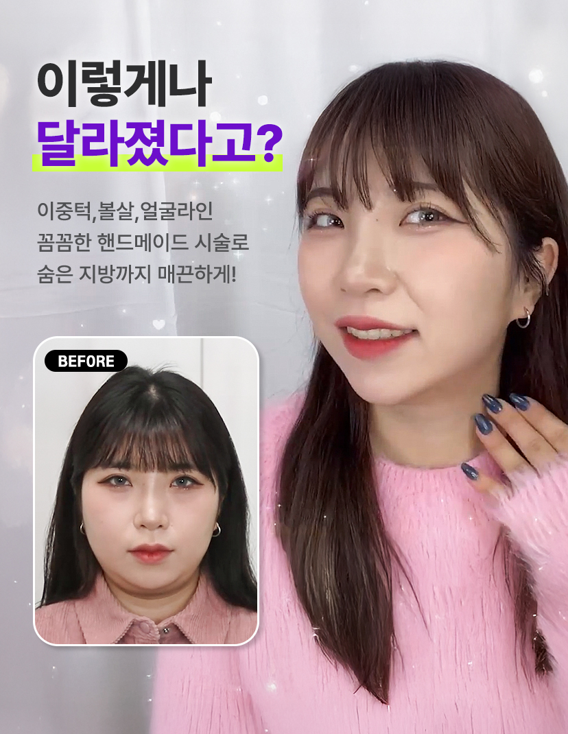 이렇게나 달라졌다고? 이중턱, 볼살, 얼굴라인 꼼꼼한 핸드메이드 시술로 숨은 지방까지 매끈하게! 얼굴팻씨 이벤트