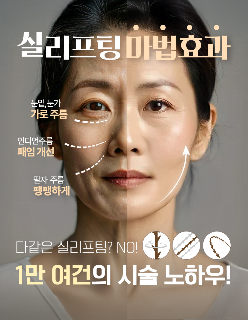 실리프팅 마법효과. 다같은 실리프팅? NO! 1만 여건의 시술 노하우! 실리프팅 이벤트